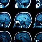 Estos son los cambios en el cerebro que produce el mindfulness según examen de IRM