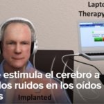Estimulación del nervio vago logra disminuir los ruidos del tinnitus
