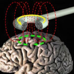 Estimulación magnética transcraneal