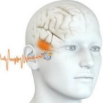 ¿Que es el acúfeno o tinnitus?