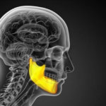 ¿Cuáles son los problemas de la articulación temporomandibular asociados al oído?