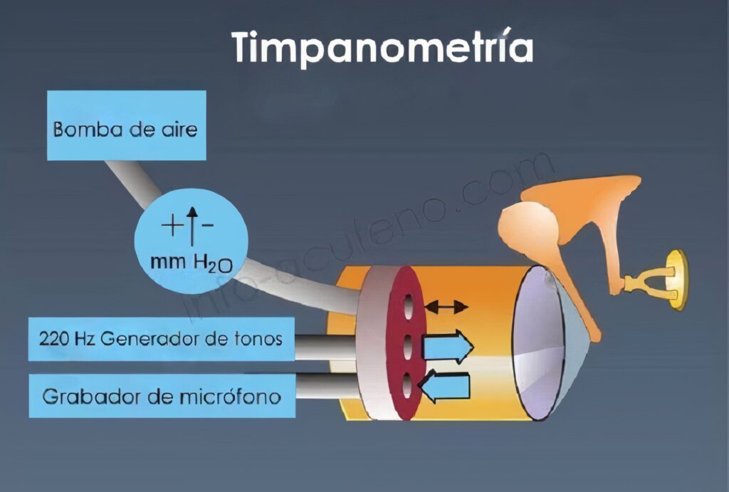 Timpanometría
