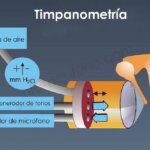 Timpanometría