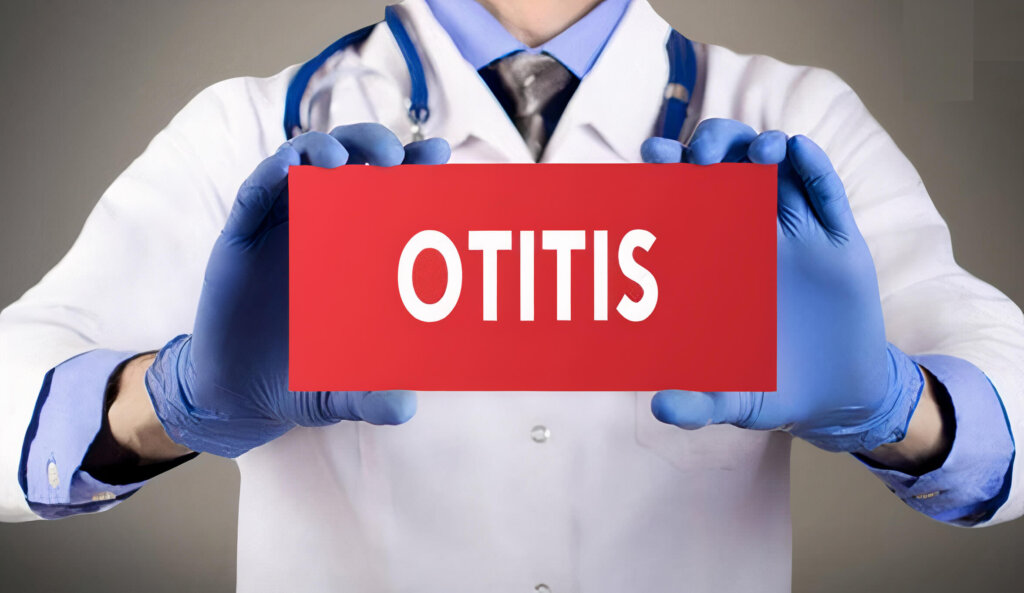 Otitis