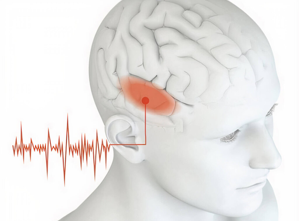 Tinnitus