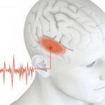Tinnitus