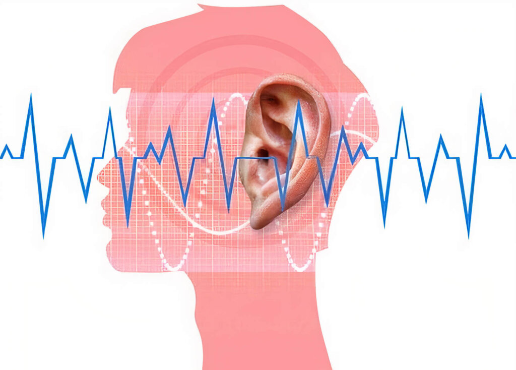 Top 10 Mitos Sobre El Tinnitus