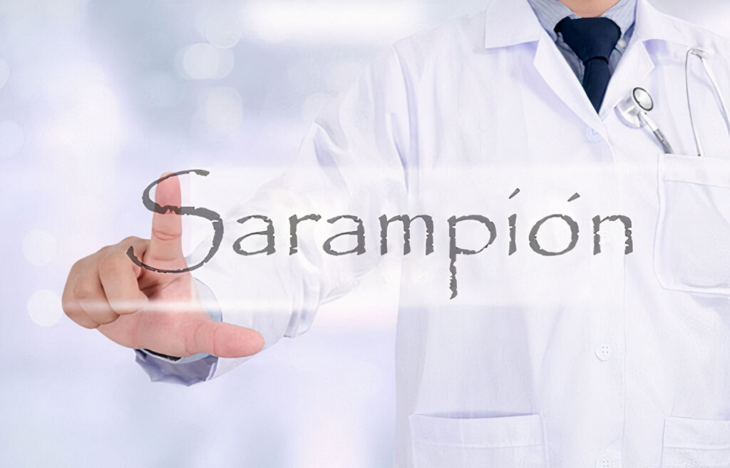 Sarampión