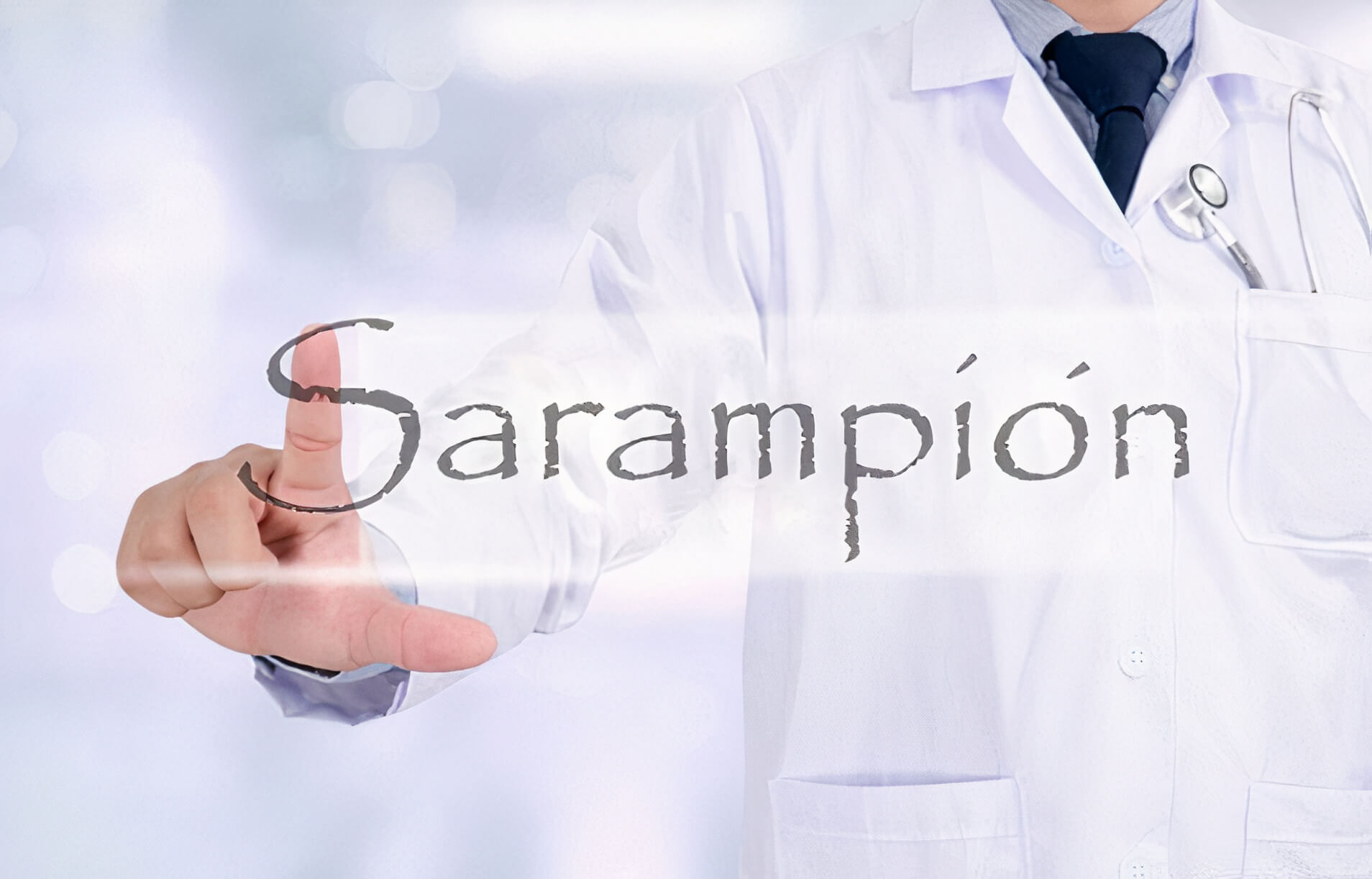 Sarampión