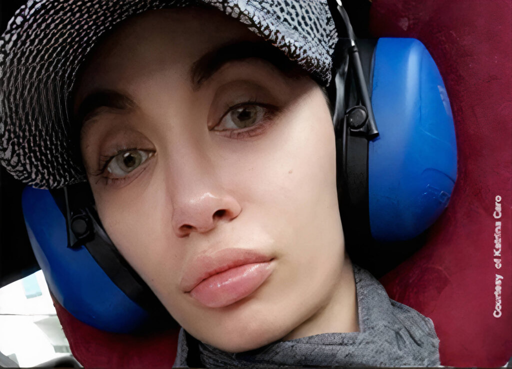 La hiperacusia y el tinnitus que atormenta a la modelo Katrina Caro