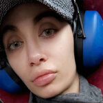 La hiperacusia y el tinnitus que atormenta a la modelo Katrina Caro