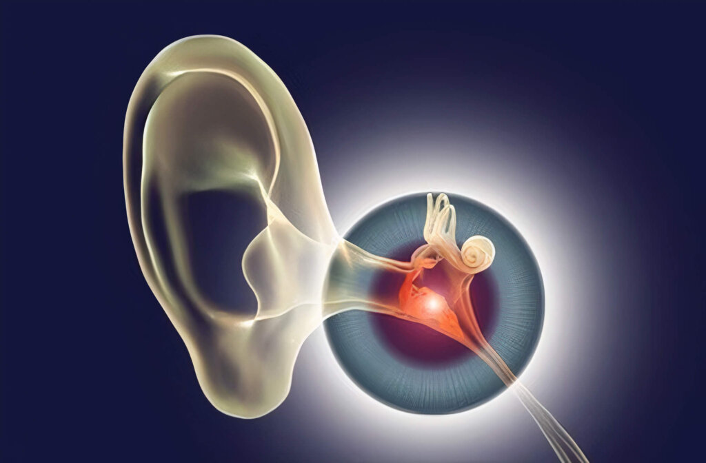 Tinnitus