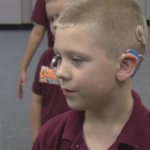 Inteligencia artificial para predecir la capacidad del lenguaje en niños sordos tras un implante coc...