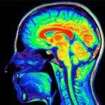 Las lesiones cerebrales traumáticas incrementan el riesgo de pérdida de audición