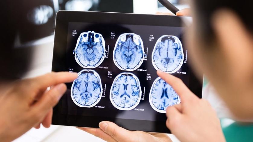 ¿Tinnitus Afecta El Cerebro?