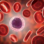 Nuevos biomarcadores ayudan a predecir la respuesta al tratamiento en un tumor cerebral común