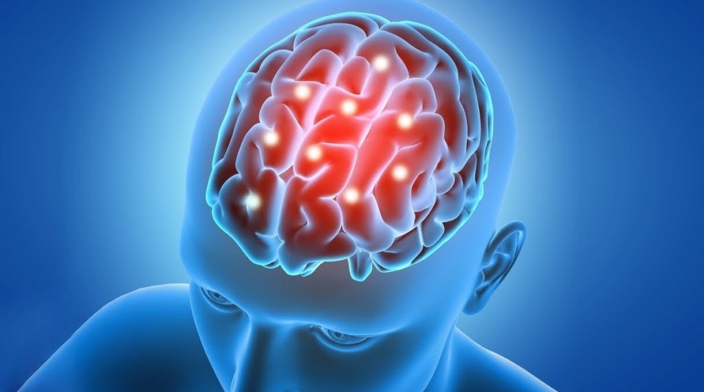 Tinnitus