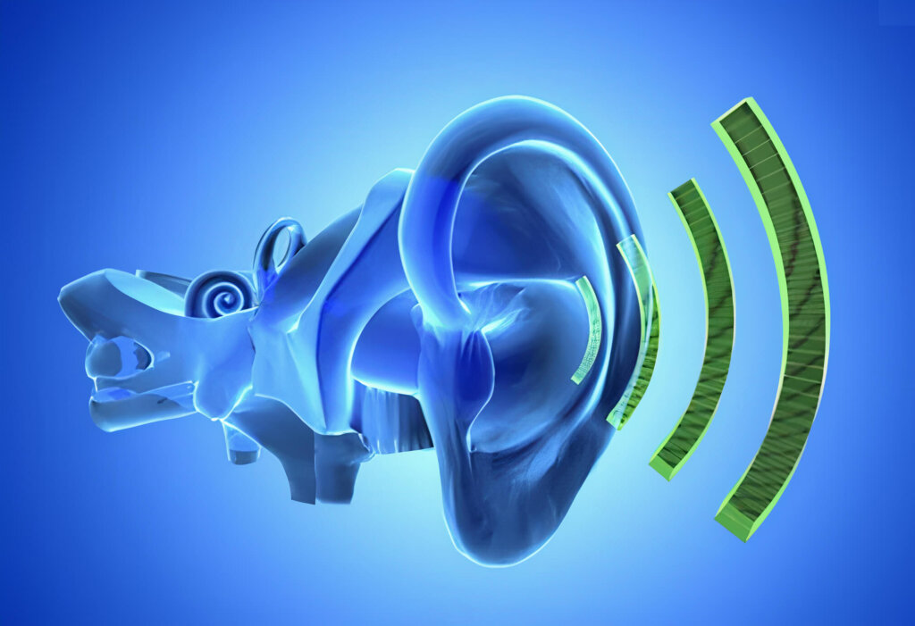 Tinnitus