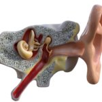 Terapias para el tinnitus