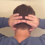 Tinnitus