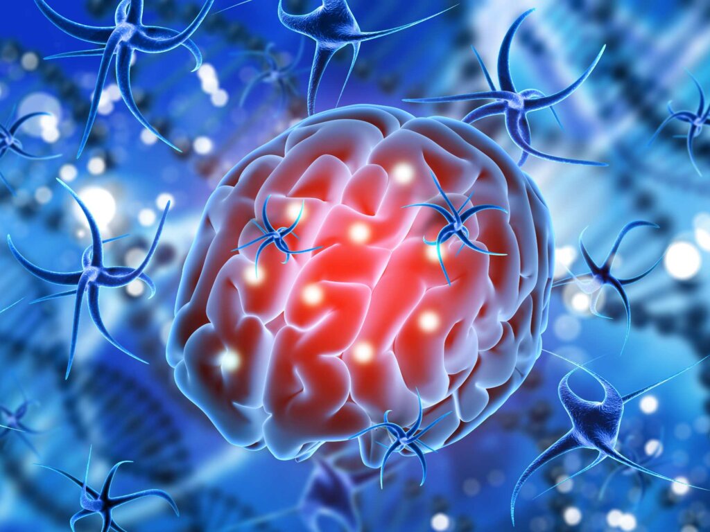Cerebro