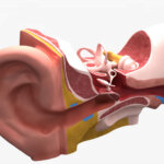 tinnitus y pérdida audiiva