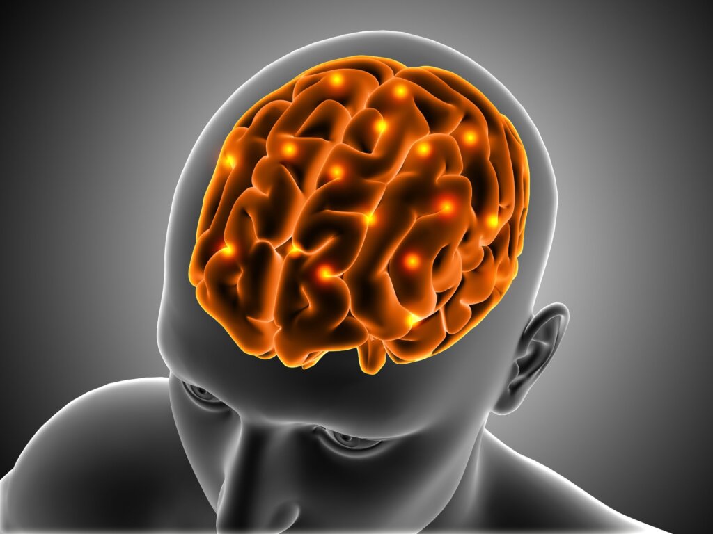 Tinnitus