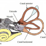 ¿Qué es BPPV?