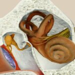 Perspectiva Integral sobre la Enfermedad de Ménière: Síntomas, Factores de Riesgo y Estrategias de M...