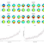 Investigación Revela Esfuerzo Auditivo en Pacientes con Tinnitus Mediante EEG y Pupilometría