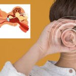 Otosclerosis y Tinnitus: Síntomas, Tratamientos y Riesgos Quirúrgicos