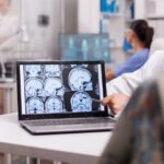 Señales nerviosas entre el cerebro y el oído podrían explicar el tinnitus, según nuevo estudio.
