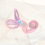 Enfermedad de Ménière: un caso clínico que ayuda a entender mejor un trastorno complejo del oído int...