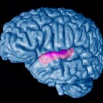 Tinnitus y pérdida auditiva: un estudio revela diferencias en la reorganización del cerebro
